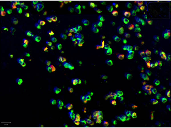 Immunofluorescence of Anti-SARS CoV Nucleocapsid Immunofluorescence of Anti-SARS CoV Nucleocapsid