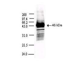 Anti-SARS CoV Nucleocapsid (N) protein Antibody - Western Blot Anti-SARS CoV Nucleocapsid (N) protein Antibody - Western Blot
