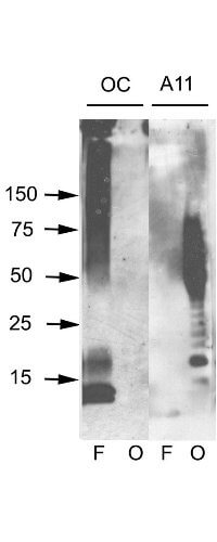 Amyloid Oligomers Western Blot Amyloid Oligomers Western Blot