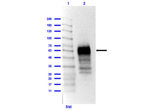 Western Blot Results of Rabbit Anti-SARS CoV-2 Nucleocapsid (N) Protein Antibody Western Blot Results of Rabbit Anti-SARS CoV-2 Nucleocapsid (N) Protein Antibody