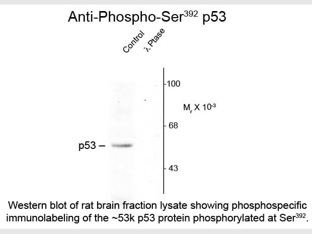 Western blot of Anti-p53 pS392 (Rabbit) Antibody - 600-401-E04 Western blot of Anti-p53 pS392 (Rabbit) Antibody - 600-401-E04