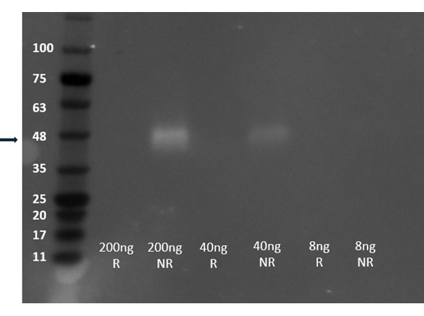 Western Blot using Recombinant VEGF receptor Western Blot using Recombinant VEGF receptor