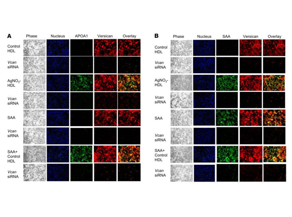 Immunofluorescence of Anti-Apolipoprotein AI Immunofluorescence of Anti-Apolipoprotein AI