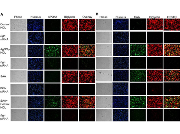 Immunofluorescence of Anti-Apolipoprotein AI Immunofluorescence of Anti-Apolipoprotein AI