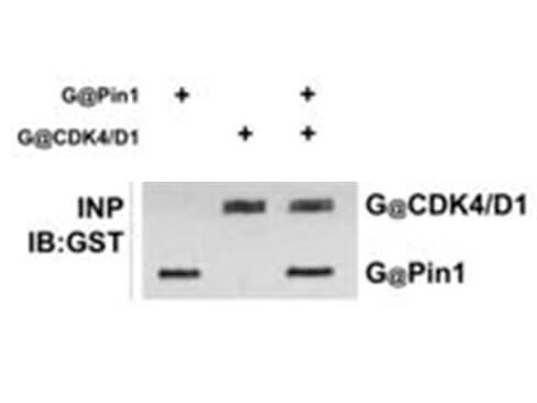 Immunoprecipitation - GST antibody Immunoprecipitation - GST antibody