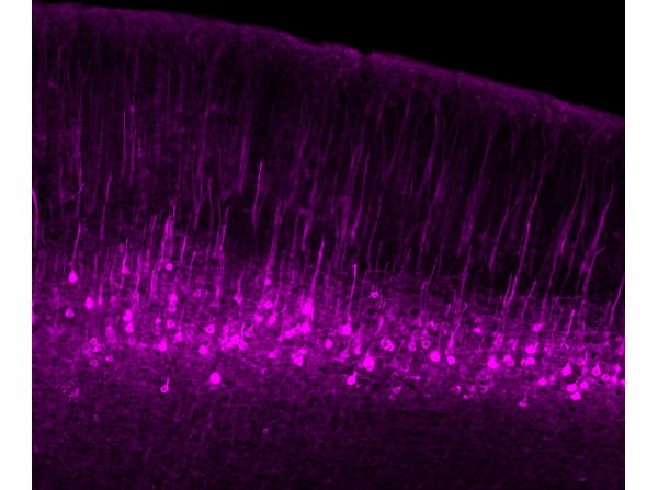 Immunofluorescence results using Goat Anti-GFP Antibody. Immunofluorescence results using Goat Anti-GFP Antibody.