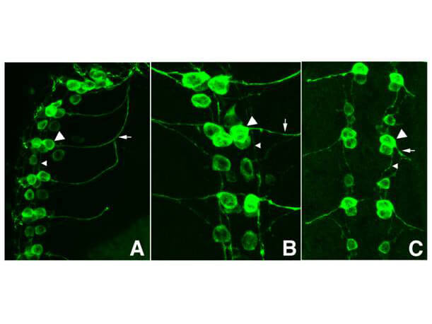 Immunofluorescence - Anti-GFP Antibody Immunofluorescence - Anti-GFP Antibody
