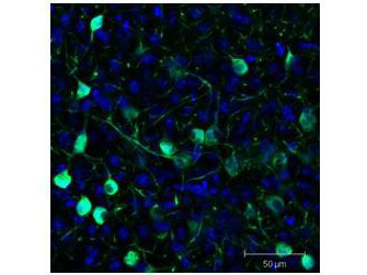 Immunofluorescence - Anti-GFP Antibody Immunofluorescence - Anti-GFP Antibody