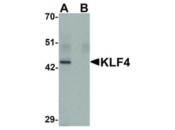 Western Blot of KLF4 Antibody Western Blot of KLF4 Antibody