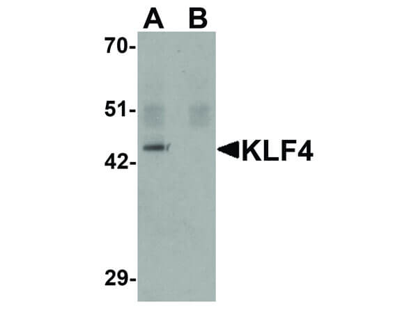 Western Blot of KLF4 Antibody Western Blot of KLF4 Antibody