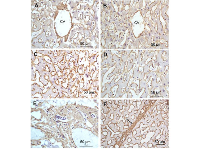 Immunohistochemistry - Anti-Collagen I Immunohistochemistry - Anti-Collagen I