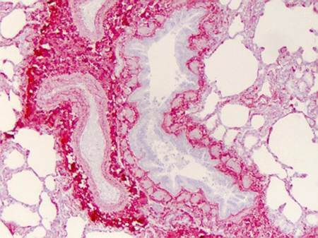 Anti-Collagen I - Immunhistochemistry Anti-Collagen I - Immunhistochemistry