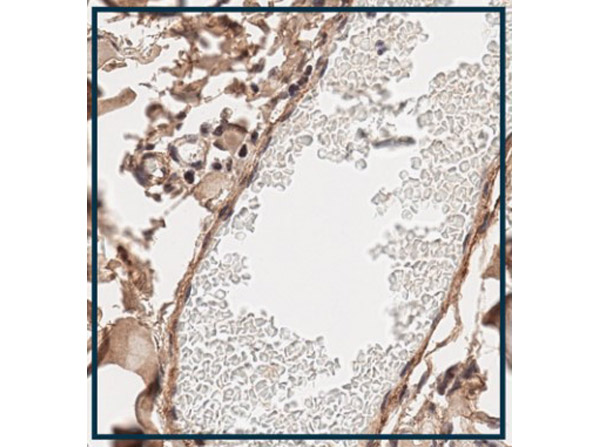Immunohistochemistry using Rabbit Anti-Collagen Type I Antibody. Immunohistochemistry using Rabbit Anti-Collagen Type I Antibody.