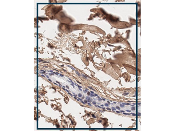 Immunohistochemistry using Rabbit Anti-Collagen Type I Antibody. Immunohistochemistry using Rabbit Anti-Collagen Type I Antibody.