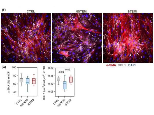 Immunofluorescence of Rabbit Anti-Collagen Type I Antibody Immunofluorescence of Rabbit Anti-Collagen Type I Antibody