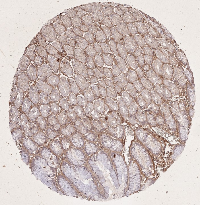Immunohistochemistry of Rabbit Anti-Collagen Type I Immunohistochemistry of Rabbit Anti-Collagen Type I