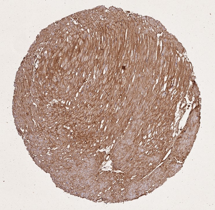 Immunohistochemistry of Rabbit Anti-Collagen Type I Immunohistochemistry of Rabbit Anti-Collagen Type I