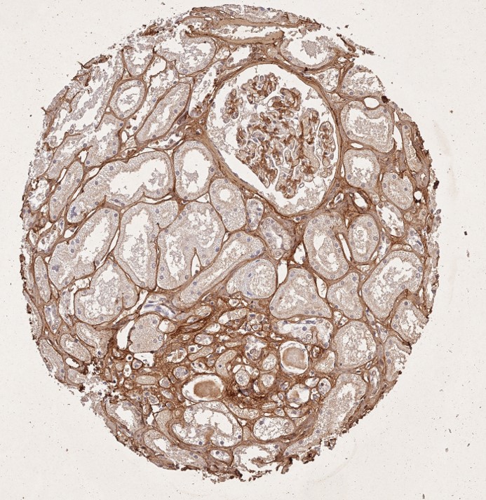 Immunohistochemistry of Rabbit Anti-Collagen Type I Immunohistochemistry of Rabbit Anti-Collagen Type I