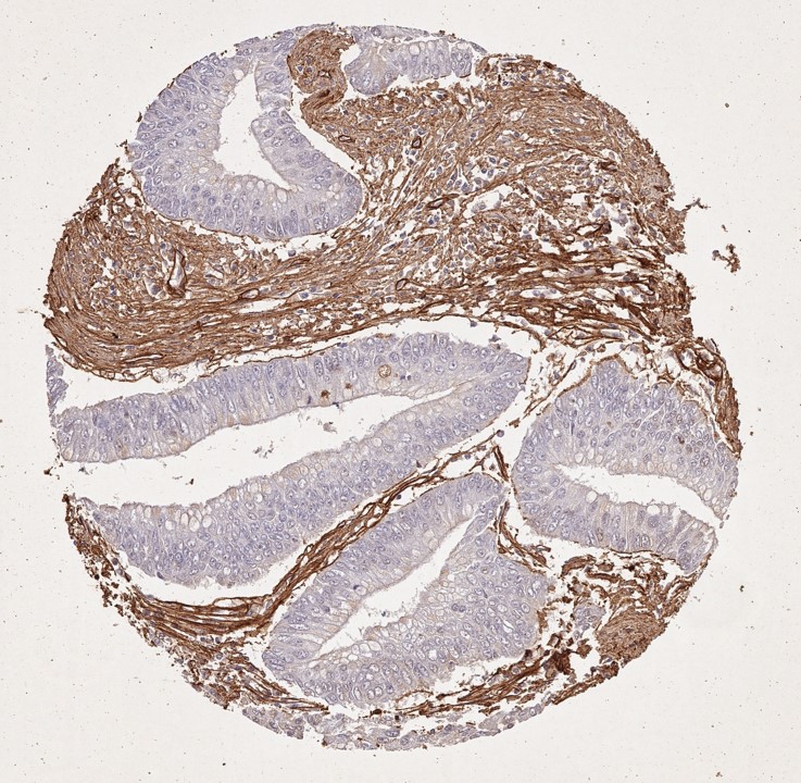 Immunohistochemistry of Rabbit Anti-Collagen Type I Immunohistochemistry of Rabbit Anti-Collagen Type I