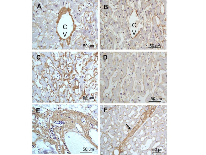 Immunohistochemistry - Anti-Collagen III Immunohistochemistry - Anti-Collagen III