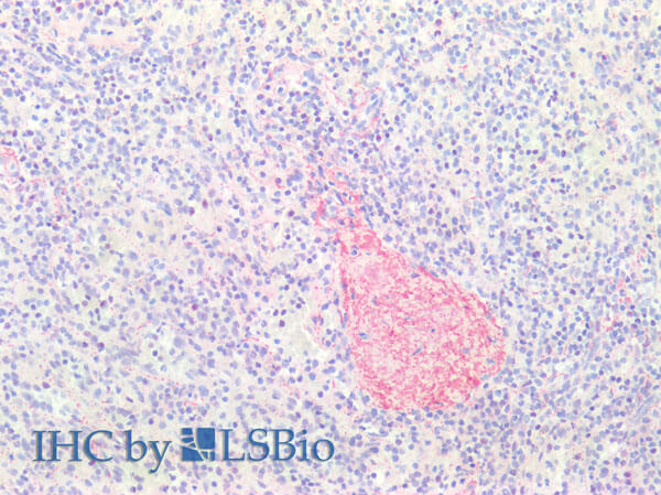 Immunohistochemistry of Anti-Collagen Type III Antibody Immunohistochemistry of Anti-Collagen Type III Antibody