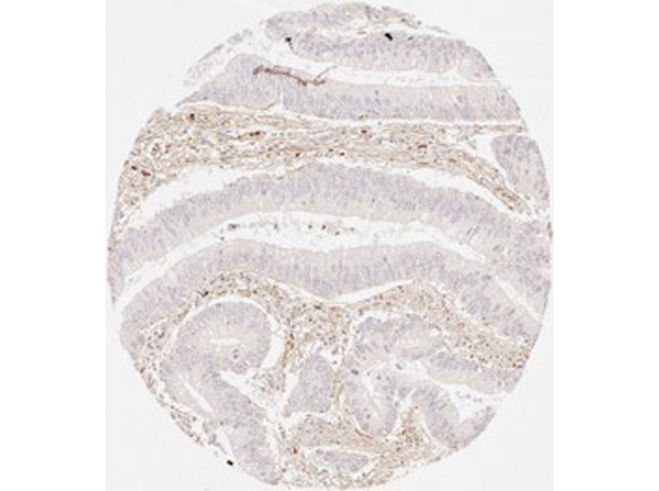 Immunohistochemistry of Rabbit Anti-Collagen Type III Immunohistochemistry of Rabbit Anti-Collagen Type III