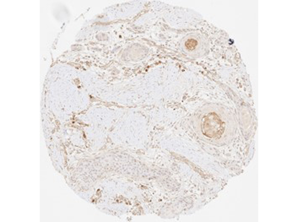 Immunohistochemistry of Rabbit Anti-Collagen Type III Immunohistochemistry of Rabbit Anti-Collagen Type III
