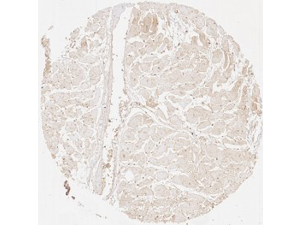 Immunohistochemistry of Rabbit Anti-Collagen Type III Immunohistochemistry of Rabbit Anti-Collagen Type III