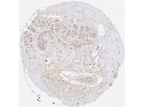 Immunohistochemistry of Rabbit Anti-Collagen Type III Immunohistochemistry of Rabbit Anti-Collagen Type III
