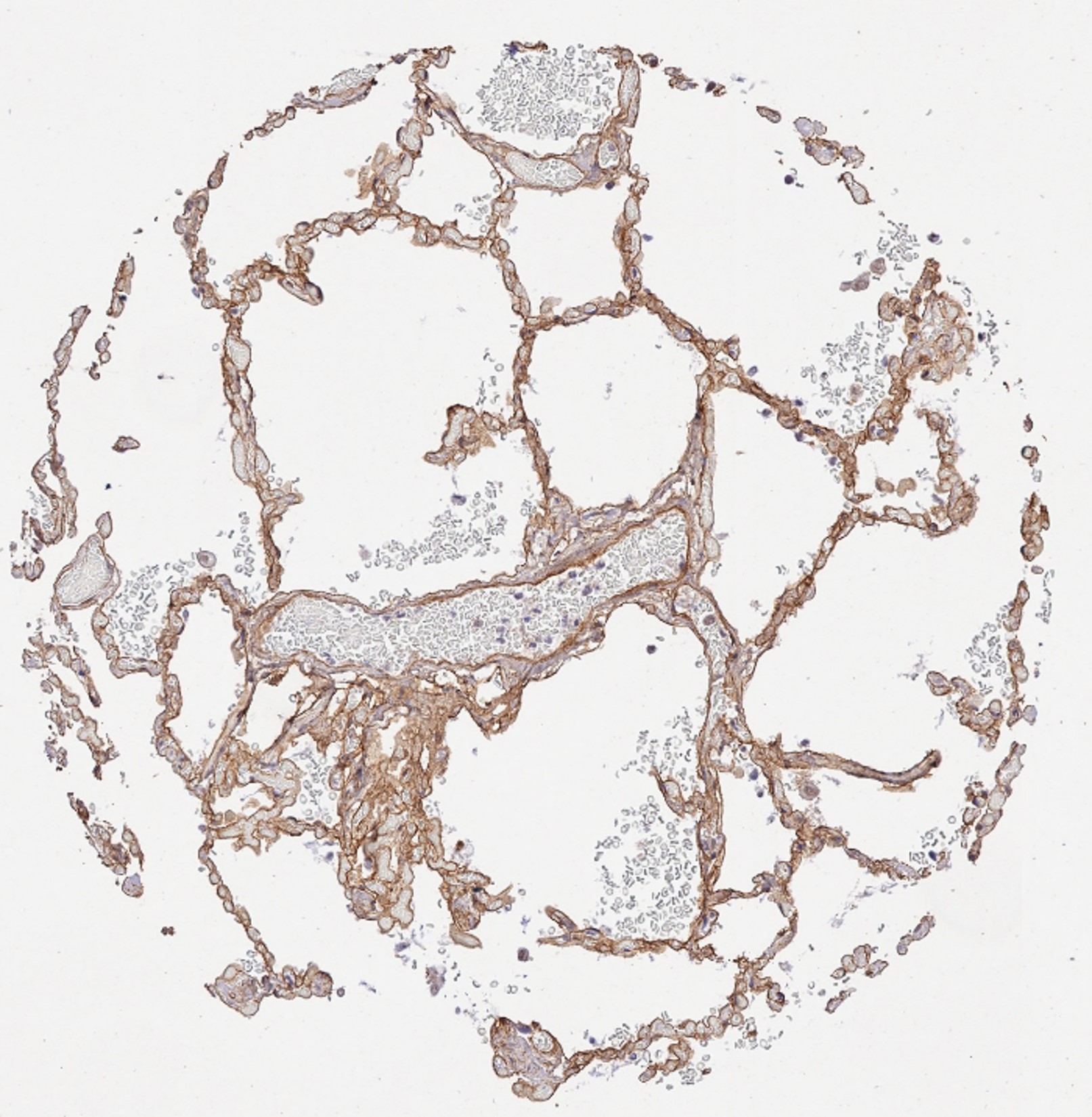 Immunohistochemistry of Rabbit Anti-Collagen Type IV Immunohistochemistry of Rabbit Anti-Collagen Type IV