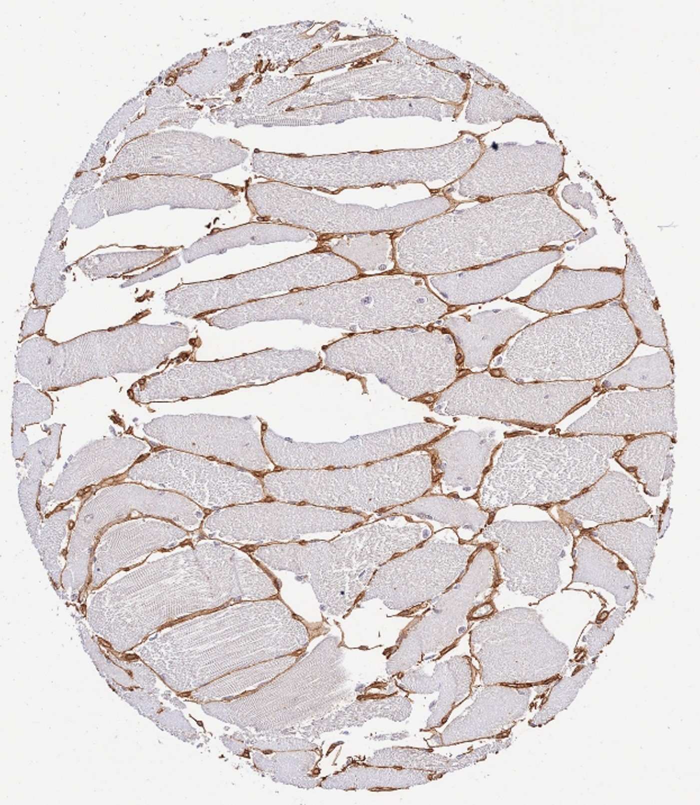 Immunohistochemistry of Rabbit Anti-Collagen Type IV Immunohistochemistry of Rabbit Anti-Collagen Type IV