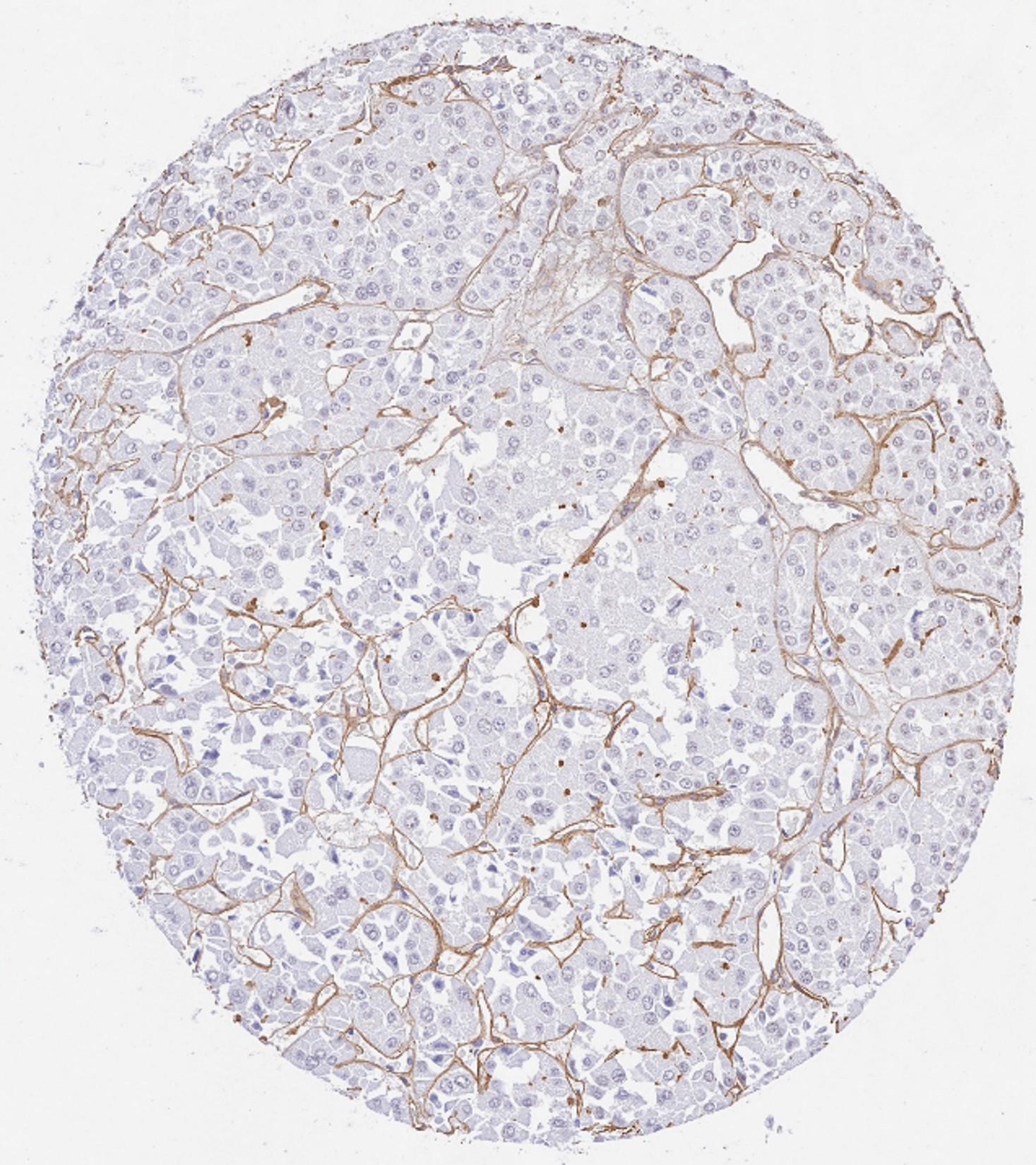 Immunohistochemistry of Rabbit Anti-Collagen Type IV Immunohistochemistry of Rabbit Anti-Collagen Type IV