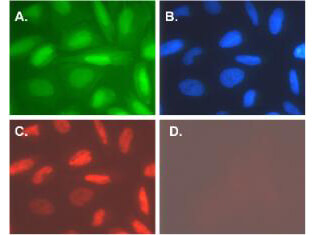 Anti-hTERT Antibody  - Immunofluorescence Microscopy Anti-hTERT Antibody  - Immunofluorescence Microscopy
