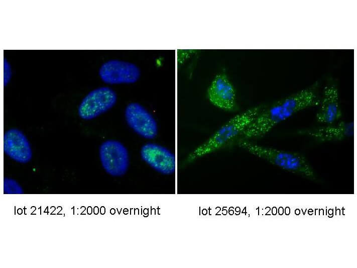 Anti-hTERT Antibody - Immunofluorescence Microscopy Anti-hTERT Antibody - Immunofluorescence Microscopy