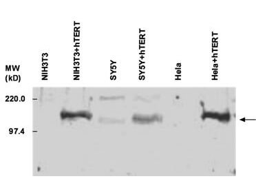 Anti-hTERT Anitbody - Western Blot Anti-hTERT Anitbody - Western Blot