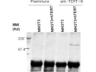 Anti-hTERT Antibody  - Immunoprecipitation/Western Blot Anti-hTERT Antibody  - Immunoprecipitation/Western Blot