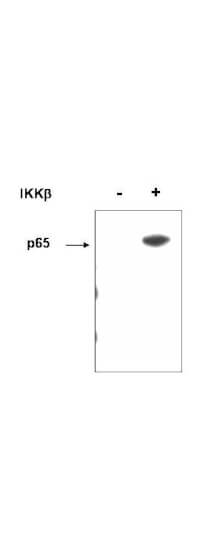 Anti-p65 (RelA) pS536 Antibody - Western Blot Anti-p65 (RelA) pS536 Antibody - Western Blot