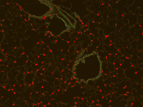Immunofluorescence Microscopy - Anti-RFP antibody Immunofluorescence Microscopy - Anti-RFP antibody