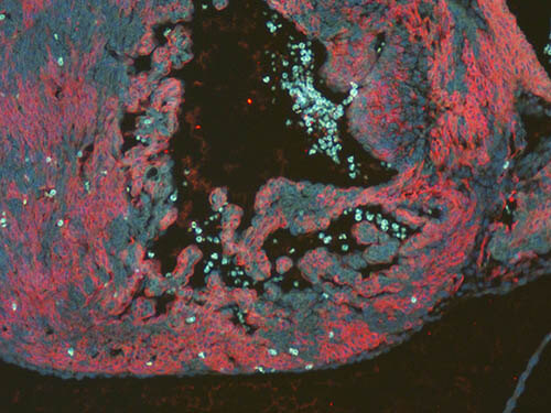 Immunofluorescence Microscopy - Anti-RFP antibody Immunofluorescence Microscopy - Anti-RFP antibody