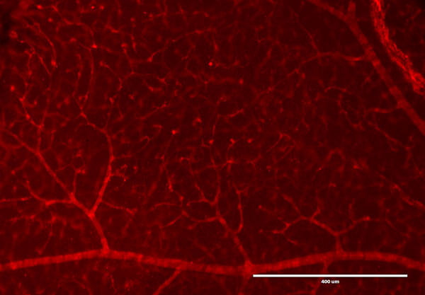 Immunofluorescence Microscopy of Rabbit Anti-RFP antibody. Immunofluorescence Microscopy of Rabbit Anti-RFP antibody.