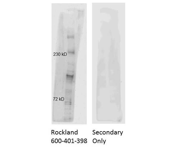 Anti ATM Antibody Western blot Anti ATM Antibody Western blot