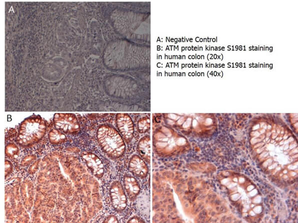Immunohistochemistry of Anti-ATM Antibody Immunohistochemistry of Anti-ATM Antibody