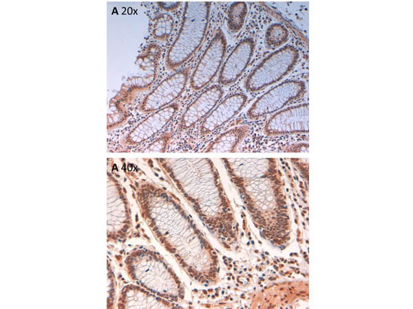 Immunohistochemistry - Anti-AuroraB pT232 Antibody Immunohistochemistry - Anti-AuroraB pT232 Antibody