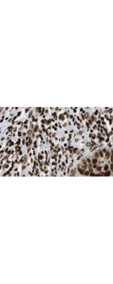 Anti-HDAC-1 Antibody - Immunohistochemistry Anti-HDAC-1 Antibody - Immunohistochemistry