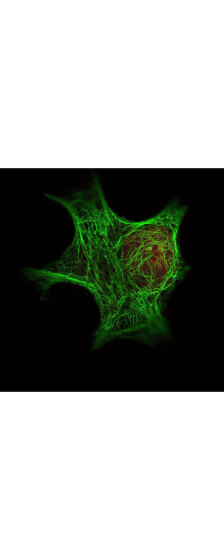 Anti HDAC-1 polyclonal antibody-Immunofluorescence Microscopy Anti HDAC-1 polyclonal antibody-Immunofluorescence Microscopy