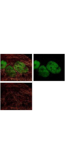 Immunofluorescence Microscopy – HDAC Antibody Immunofluorescence Microscopy – HDAC Antibody