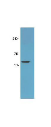 Anti-HDAC-1 Antibody - Western Blot Anti-HDAC-1 Antibody - Western Blot