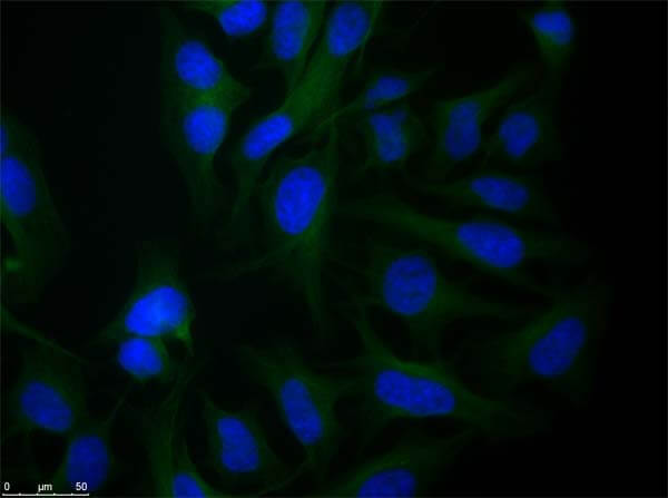 Rabbit anti-Alpha Tubulin Rabbit anti-Alpha Tubulin