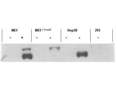 Anti-Smad3 pS423 pS425 Antibody - Western Blot Anti-Smad3 pS423 pS425 Antibody - Western Blot