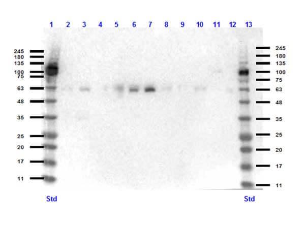Western Blot of Rabbit anti-KLF4 antibody Western Blot of Rabbit anti-KLF4 antibody